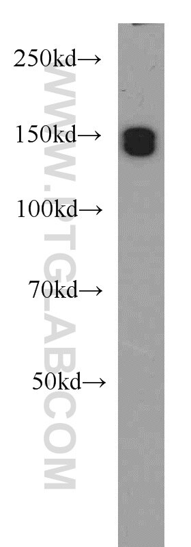 Western Blot (WB) analysis of PC-3 cells using EDRF1 Polyclonal antibody (21883-1-AP)