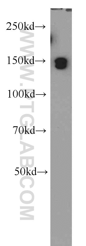 Western Blot (WB) analysis of HeLa cells using EDRF1 Polyclonal antibody (21883-1-AP)