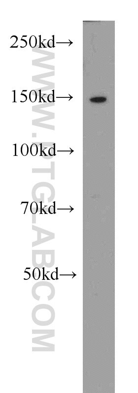 WB analysis of HEK-293 using 21883-1-AP