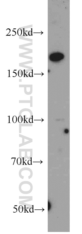 Western Blot (WB) analysis of mouse brain tissue using EDRF1 Polyclonal antibody (21883-1-AP)
