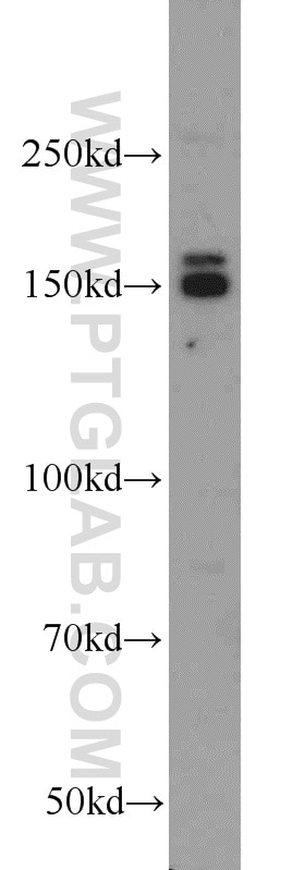 Western Blot (WB) analysis of MCF-7 cells using EDRF1 Polyclonal antibody (21883-1-AP)