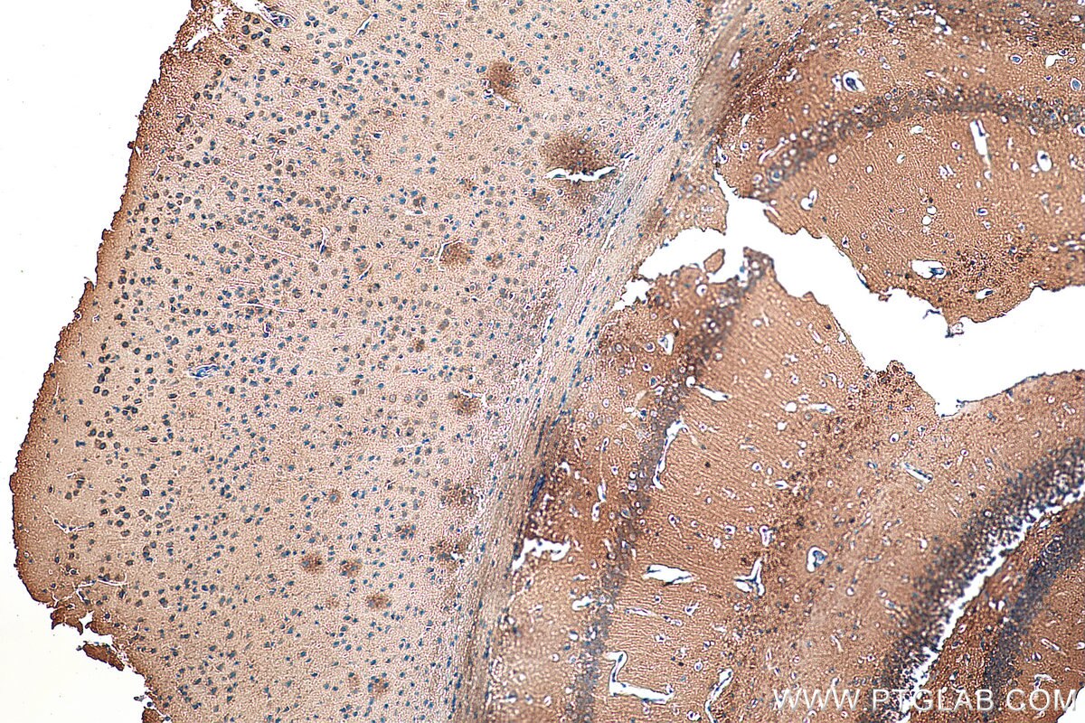 Immunohistochemistry (IHC) staining of mouse brain tissue using C10orf27 Polyclonal antibody (24424-1-AP)