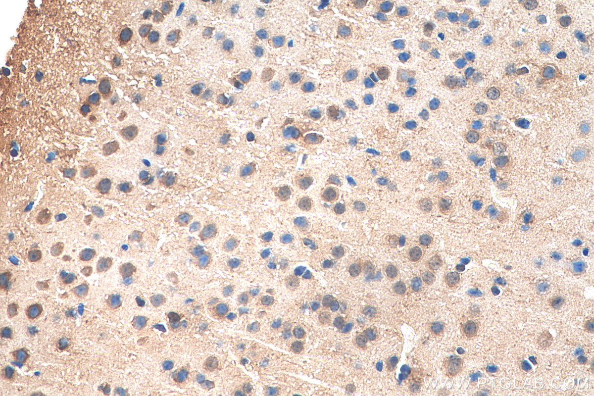 Immunohistochemistry (IHC) staining of mouse brain tissue using C10orf27 Polyclonal antibody (24424-1-AP)