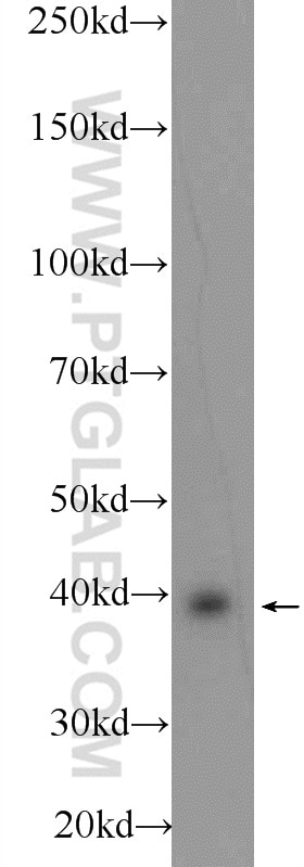 Western Blot (WB) analysis of HeLa cells using C10orf27 Polyclonal antibody (24424-1-AP)