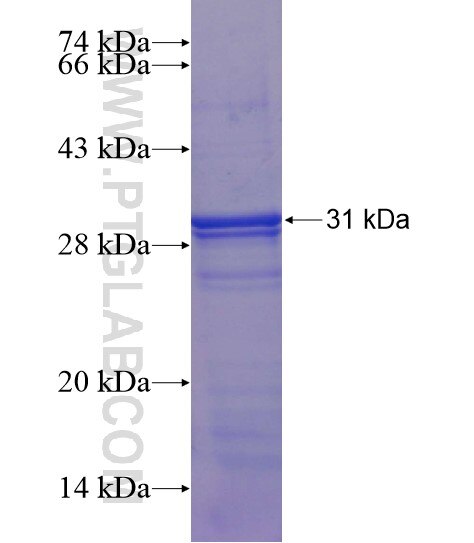 C10orf27 fusion protein Ag19625 SDS-PAGE
