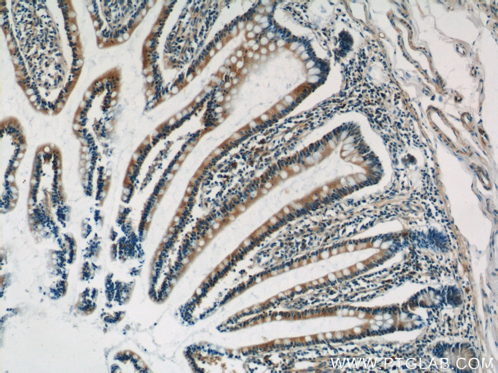 Immunohistochemistry (IHC) staining of human small intestine tissue using C10orf28 Polyclonal antibody (24967-1-AP)