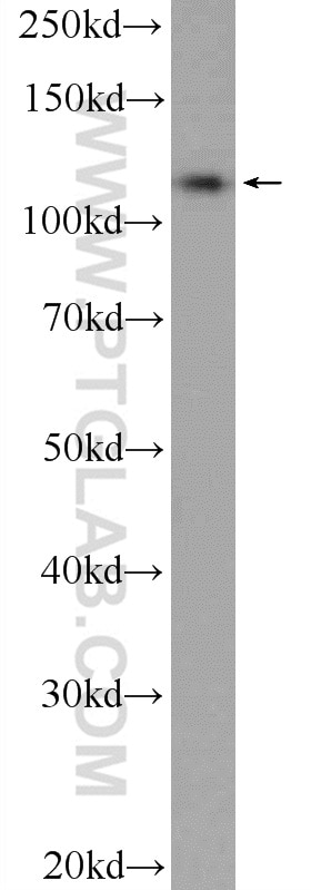 Western Blot (WB) analysis of A431 cells using C10orf28 Polyclonal antibody (24967-1-AP)