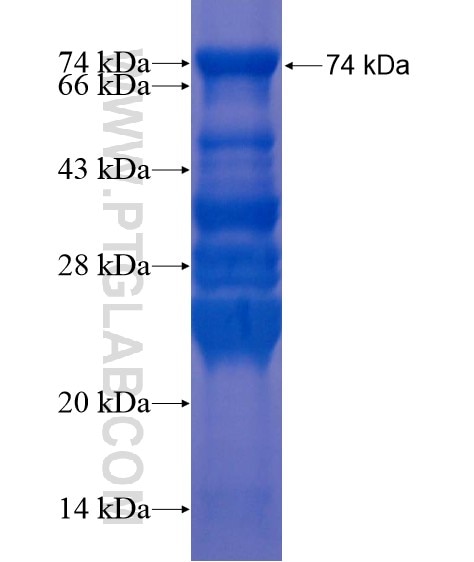 C10orf28 fusion protein Ag21740 SDS-PAGE