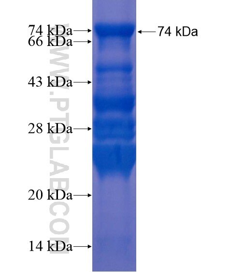 C10orf28 fusion protein Ag21740 SDS-PAGE