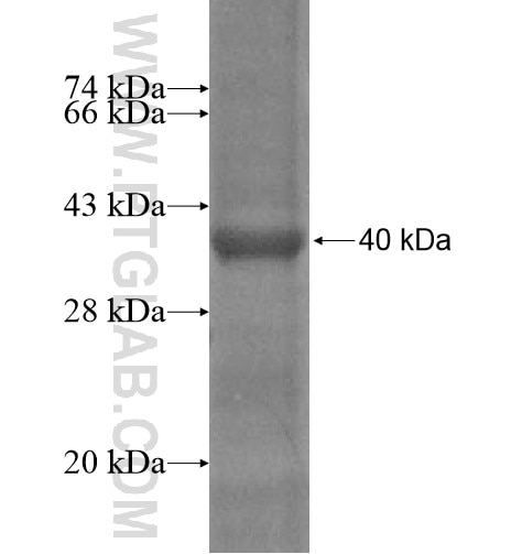 C10orf33 fusion protein Ag15004 SDS-PAGE