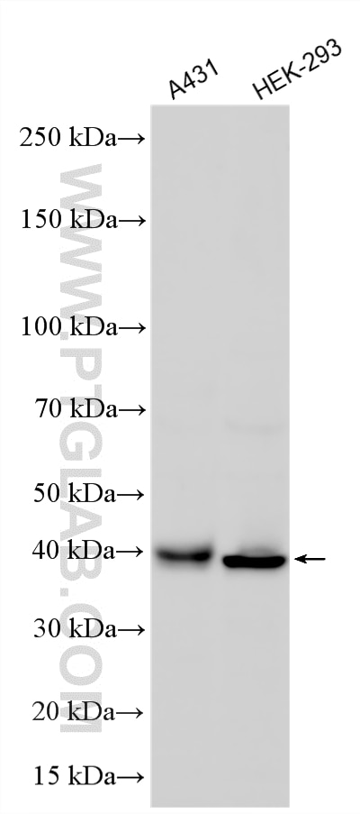 Western Blot (WB) analysis of various lysates using C10orf46 Polyclonal antibody (26321-1-AP)