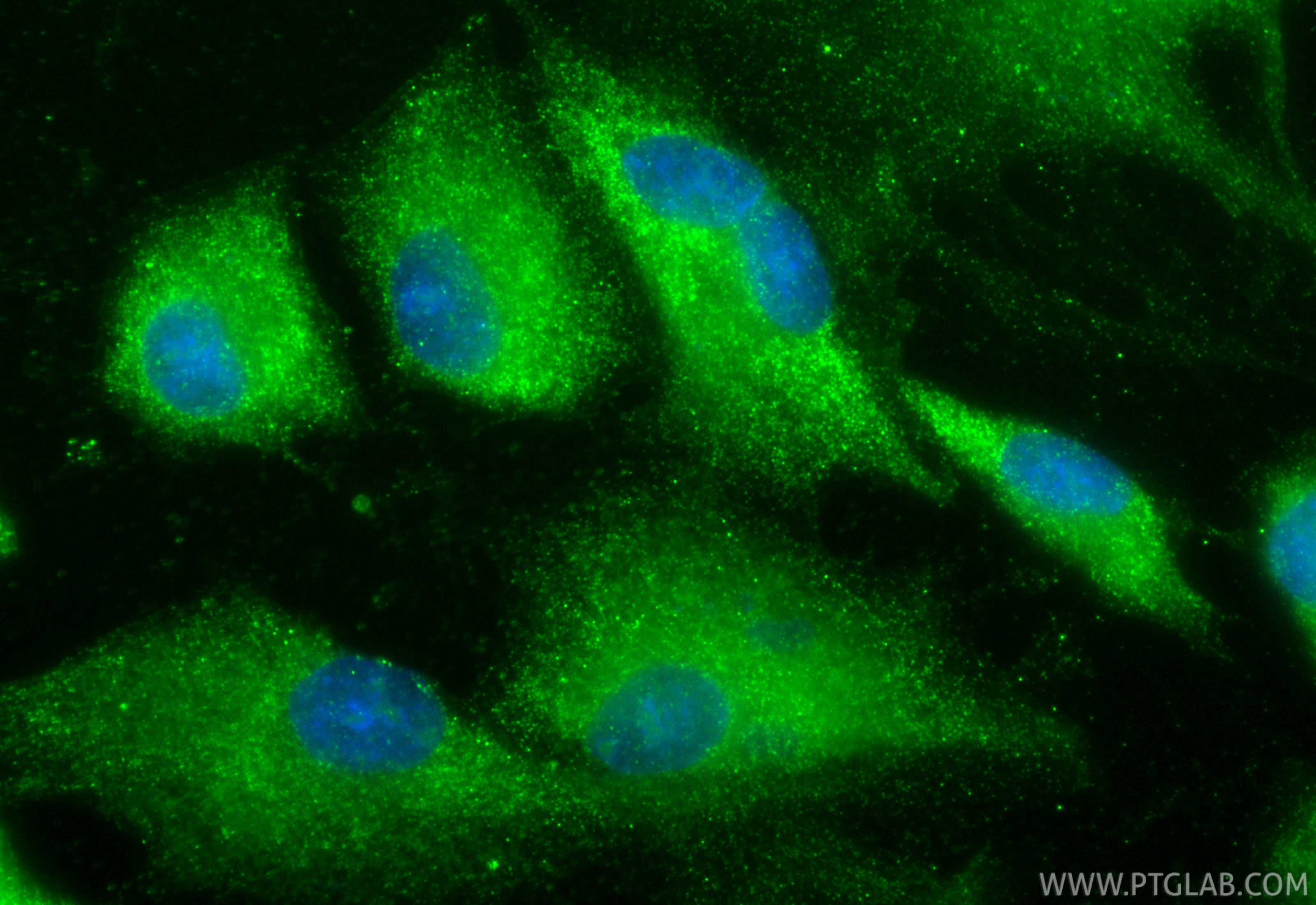 Immunofluorescence (IF) / fluorescent staining of ROS1728 cells using C10orf58 Polyclonal antibody (20446-1-AP)