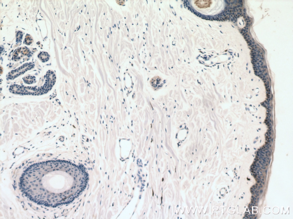 Immunohistochemistry (IHC) staining of human skin tissue using C10orf58 Polyclonal antibody (20446-1-AP)
