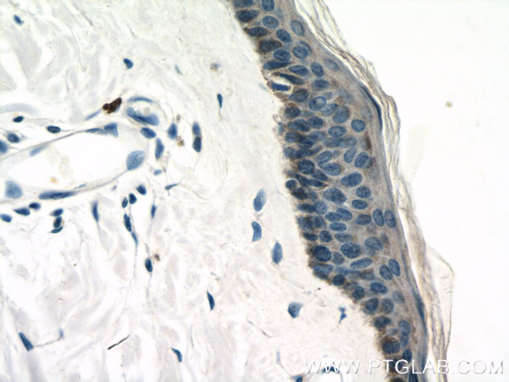 IHC staining of human skin using 20446-1-AP