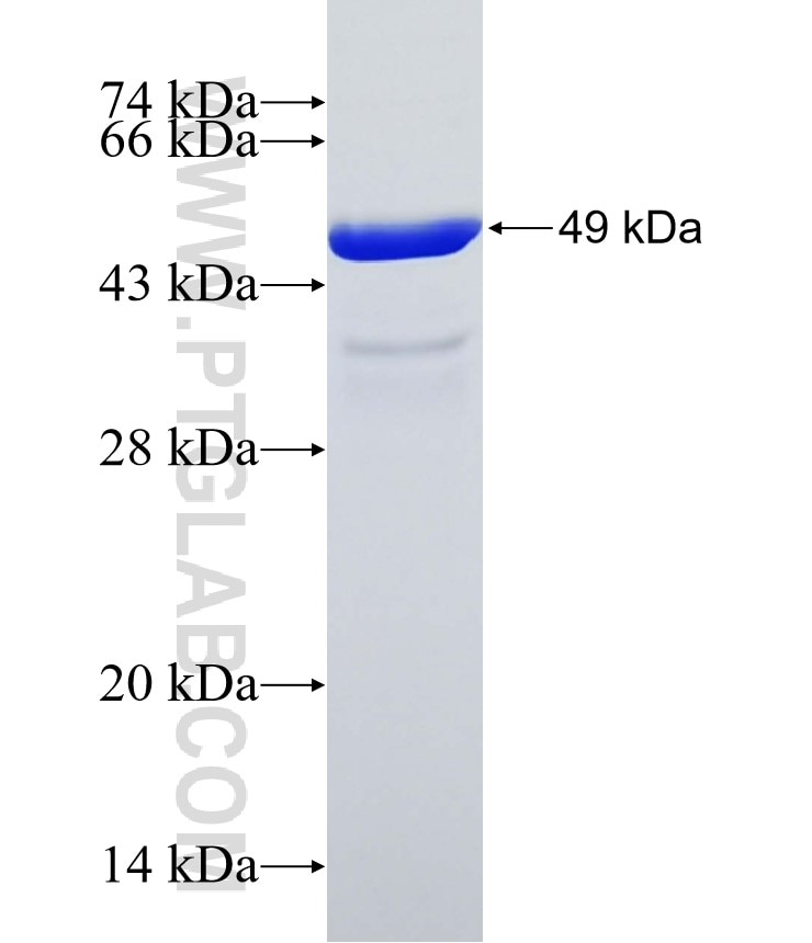 C10orf58 fusion protein Ag14272 SDS-PAGE