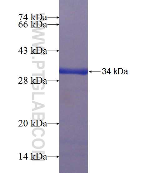 C10orf63 fusion protein Ag23762 SDS-PAGE
