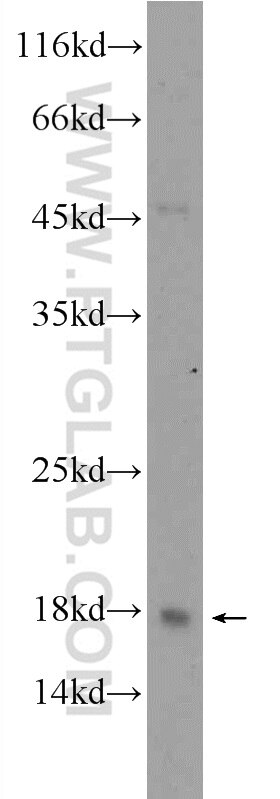 Western Blot (WB) analysis of A549 cells using C10orf67 Polyclonal antibody (24459-1-AP)