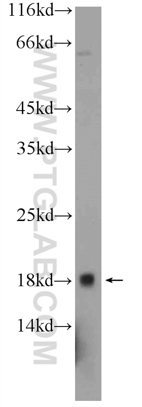 Western Blot (WB) analysis of PC-3 cells using C10orf67 Polyclonal antibody (24459-1-AP)