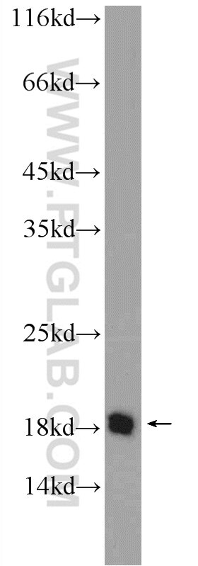 Western Blot (WB) analysis of human testis tissue using C10orf67 Polyclonal antibody (24459-1-AP)