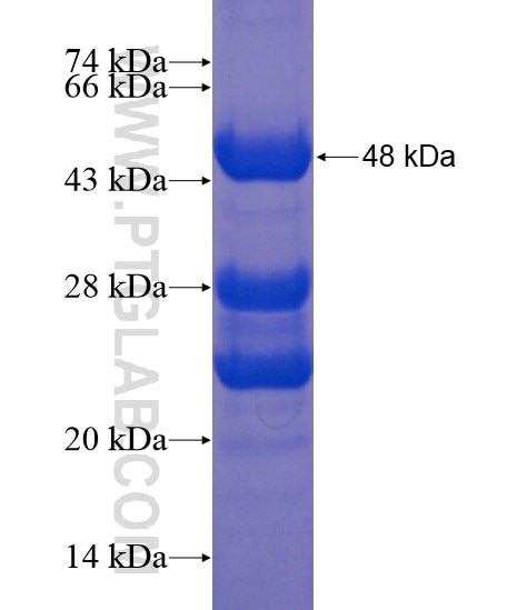 C10orf67 fusion protein Ag21465 SDS-PAGE