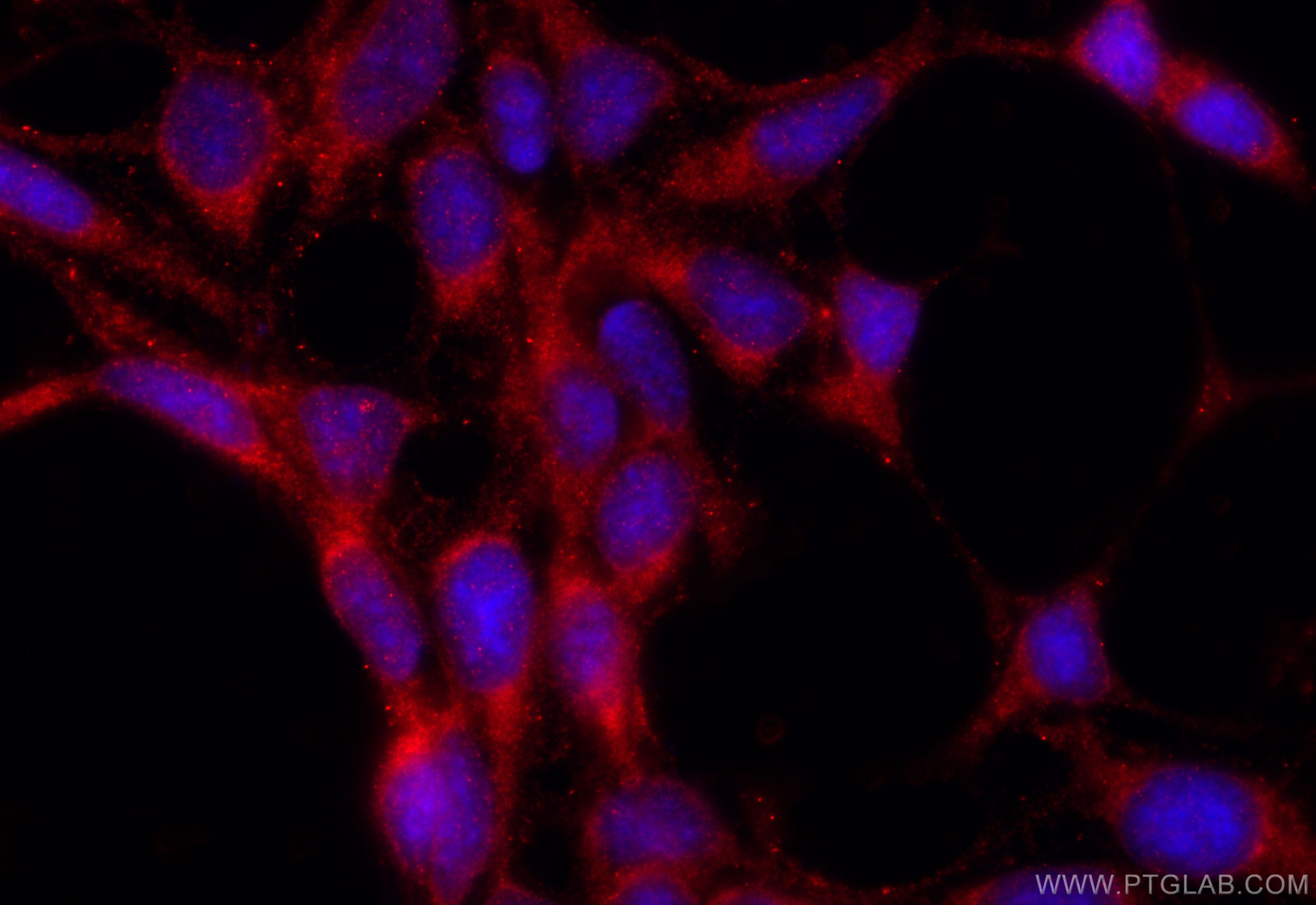 Immunofluorescence (IF) / fluorescent staining of HEK-293 cells using C10orf68 Polyclonal antibody (24975-1-AP)