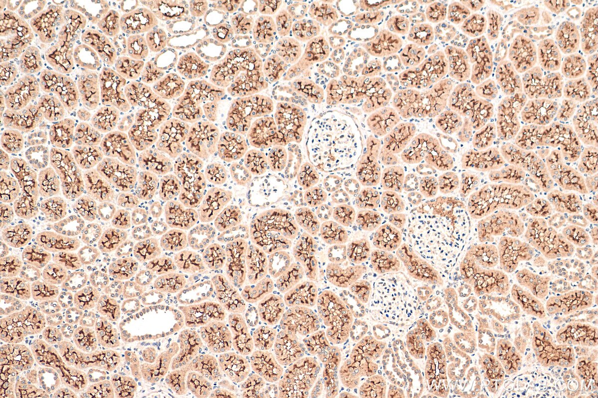 Immunohistochemistry (IHC) staining of human kidney tissue using C10orf68 Polyclonal antibody (24975-1-AP)