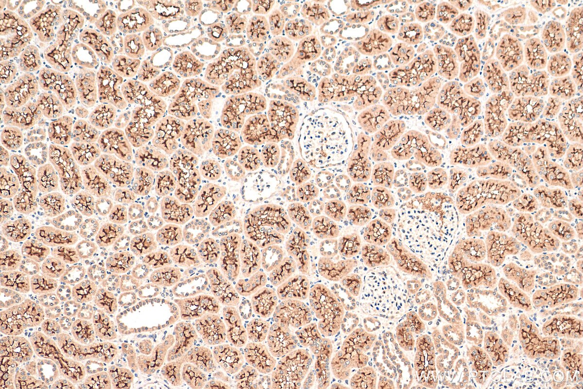 Immunohistochemistry (IHC) staining of human kidney tissue using C10orf68 Polyclonal antibody (24975-1-AP)