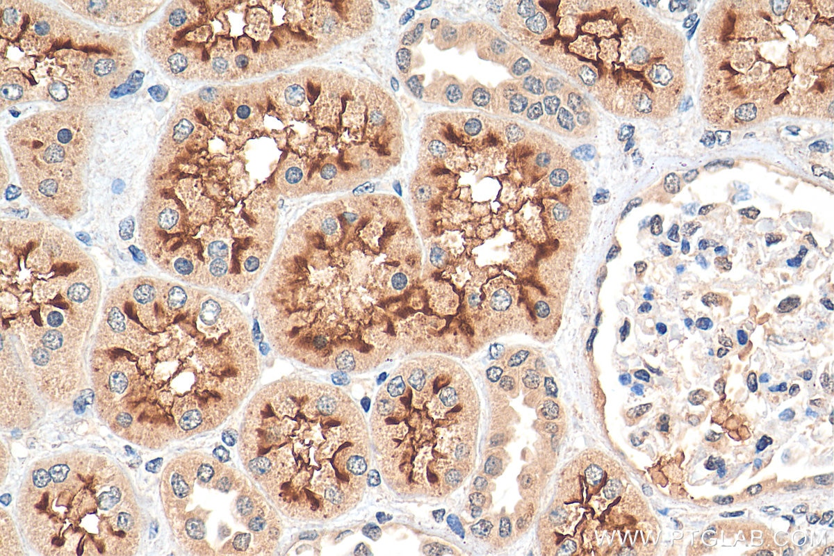 Immunohistochemistry (IHC) staining of human kidney tissue using C10orf68 Polyclonal antibody (24975-1-AP)