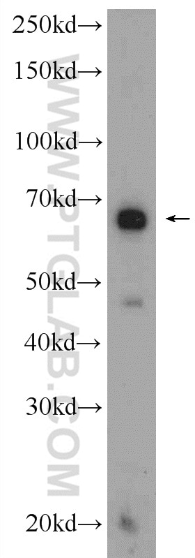 Western Blot (WB) analysis of COS-7 cells using C10orf68 Polyclonal antibody (24975-1-AP)