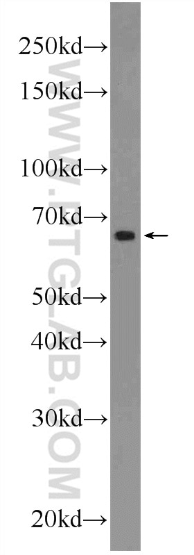 Western Blot (WB) analysis of A549 cells using C10orf68 Polyclonal antibody (24975-1-AP)