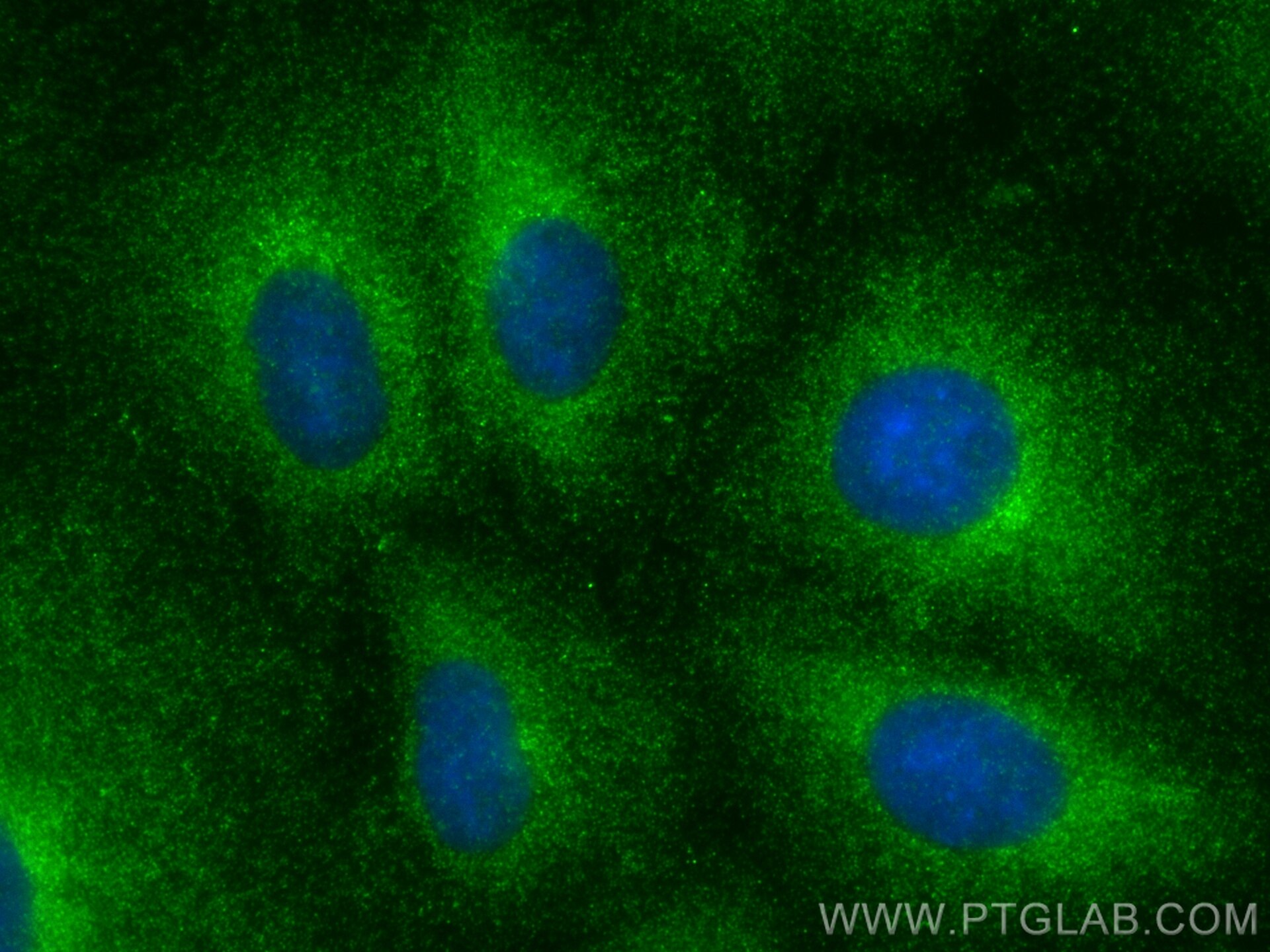 Immunofluorescence (IF) / fluorescent staining of A549 cells using C10orf88 Polyclonal antibody (26026-1-AP)