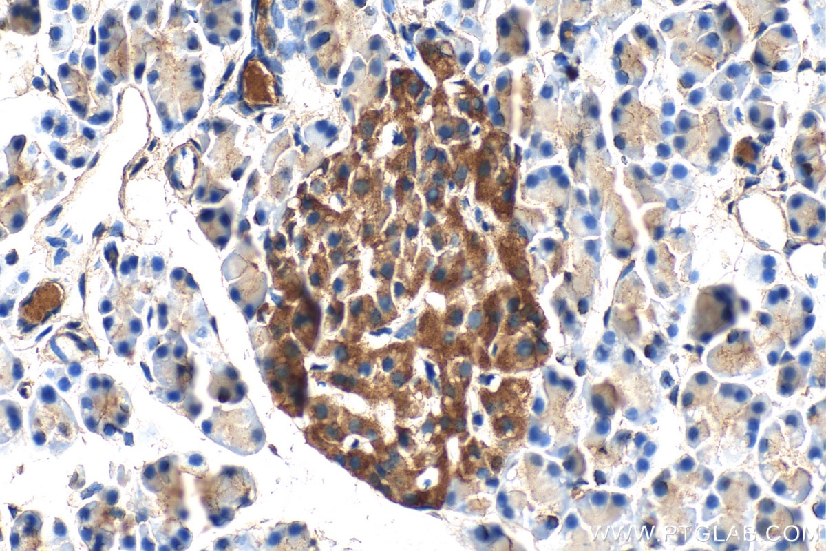 Immunohistochemistry (IHC) staining of rat pancreas tissue using C10orf88 Polyclonal antibody (26026-1-AP)
