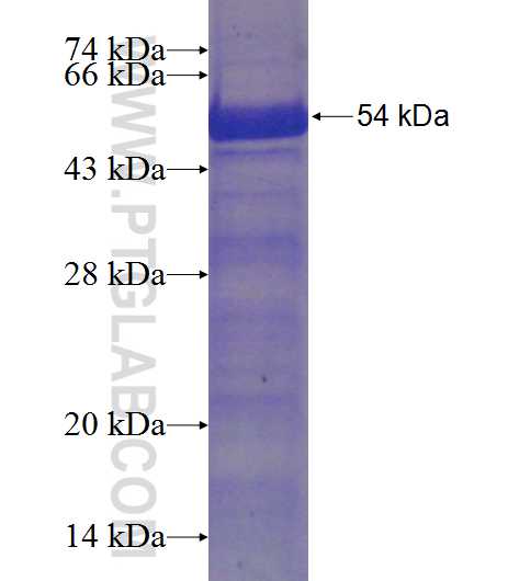 C10orf88 fusion protein Ag22971 SDS-PAGE
