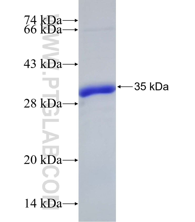C10orf90 fusion protein Ag32936 SDS-PAGE C10orf90 fusion protein Ag32936 SDS-PAGE