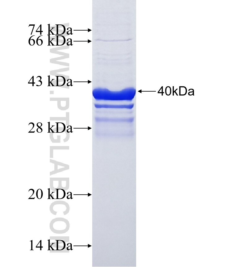 C10orf91 fusion protein Ag39251 SDS-PAGE