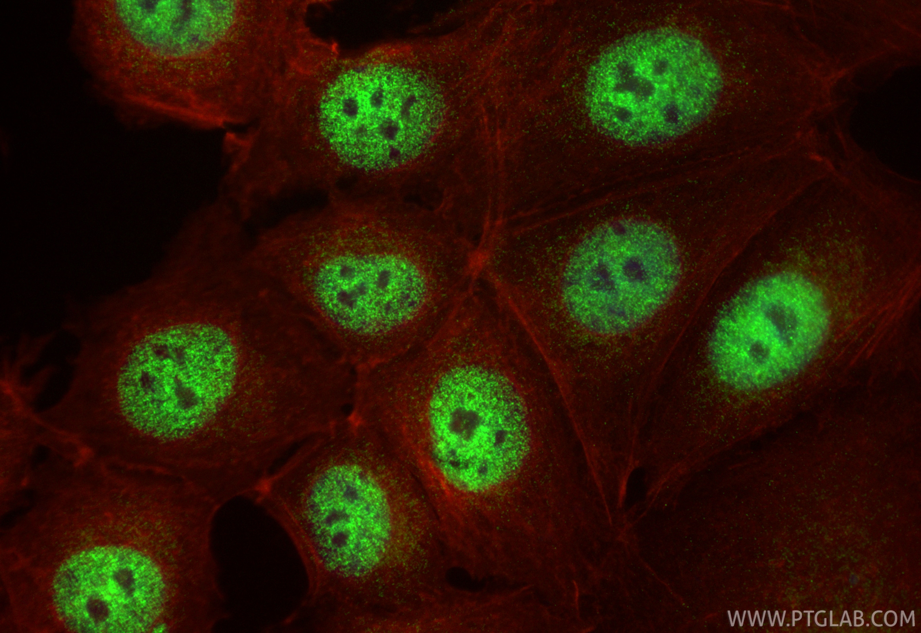 IF Staining of MCF-7 using 26212-1-AP Immunofluorescence (IF) / fluorescent staining of MCF-7 cells using C11orf30 Polyclonal antibody (26212-1-AP)