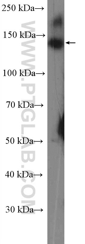 Western Blot (WB) analysis of Jurkat cells using C11orf30 Polyclonal antibody (26212-1-AP)