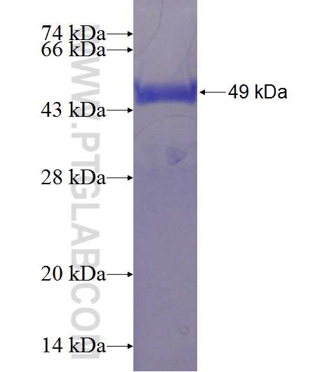 C11orf30 fusion protein Ag23974 SDS-PAGE
