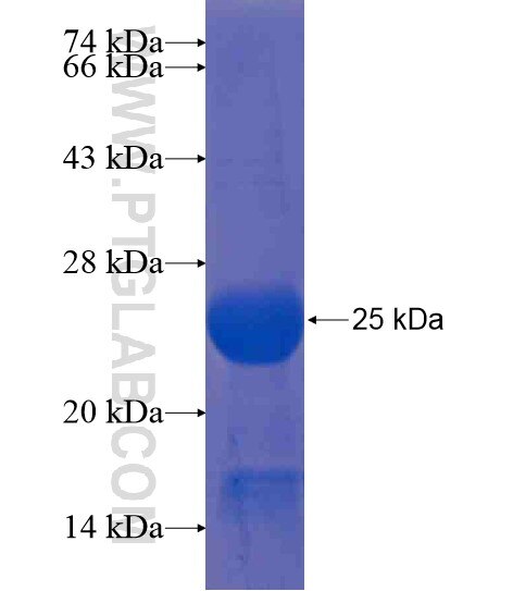 C11orf31 fusion protein Ag20685 SDS-PAGE