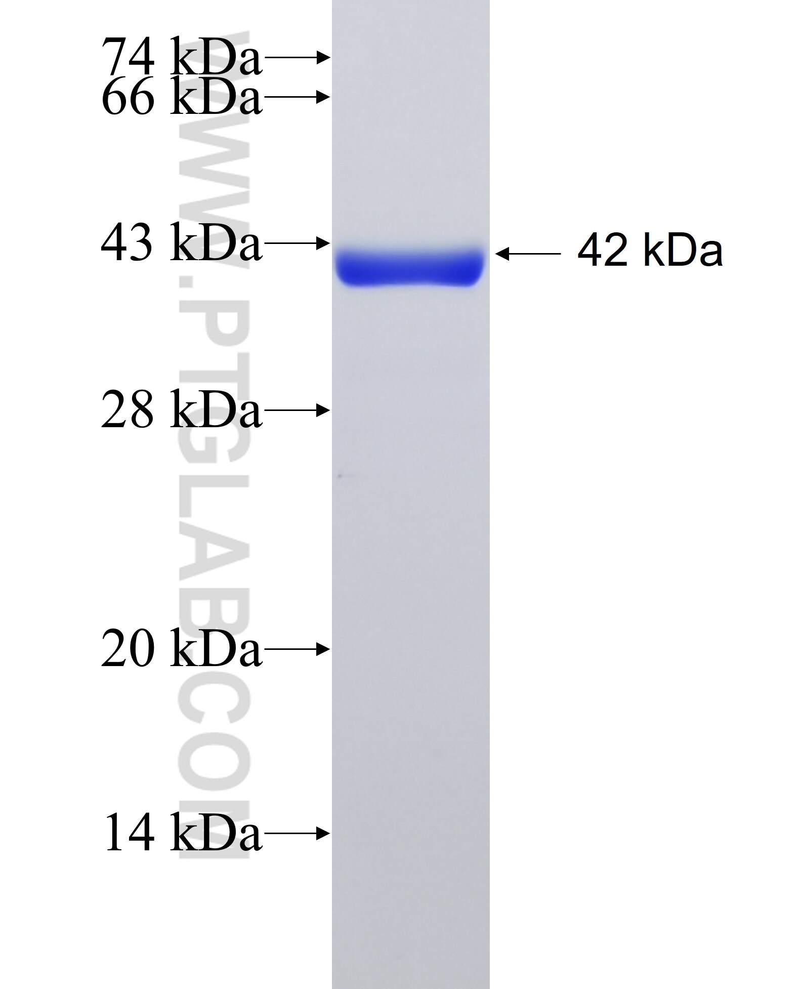 C11orf31 fusion protein Ag38887 SDS-PAGE