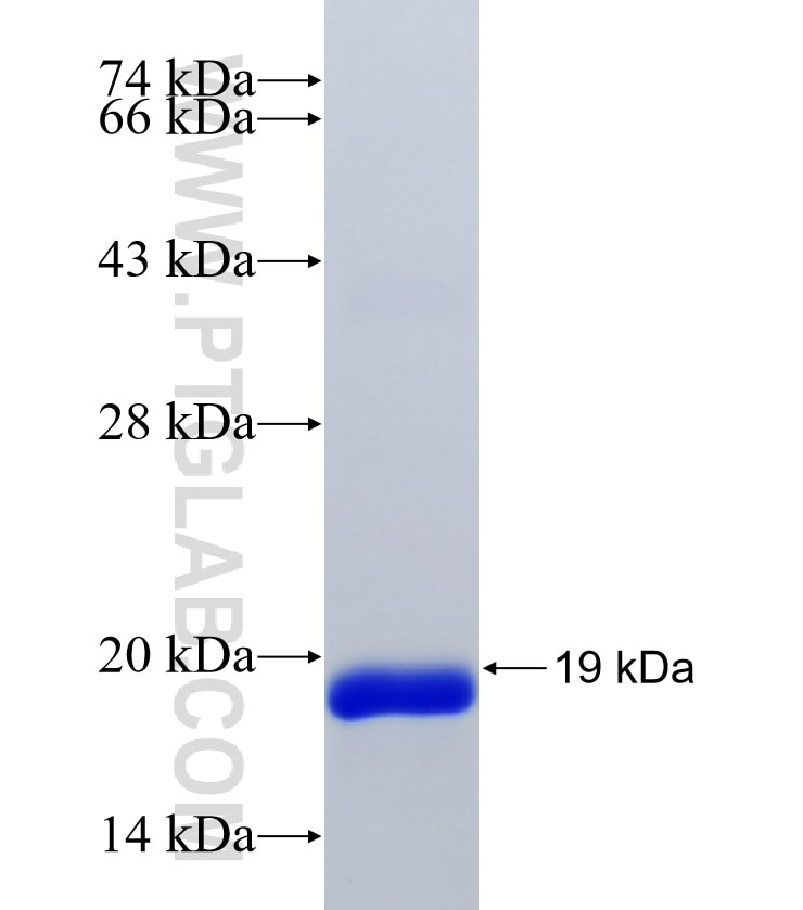 C11orf31 fusion protein Ag38889 SDS-PAGE C11orf31 fusion protein Ag38889 SDS-PAGE