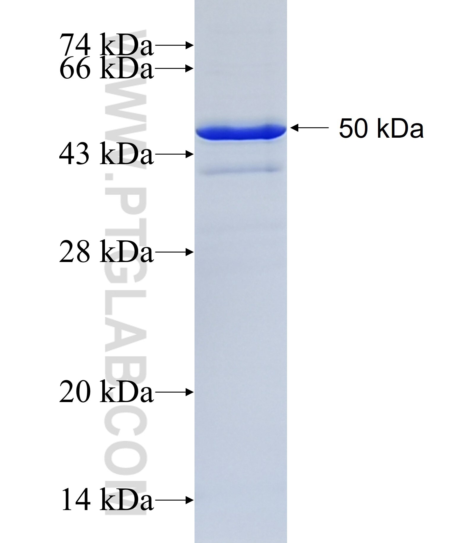 C11orf35 fusion protein Ag28088 SDS-PAGE