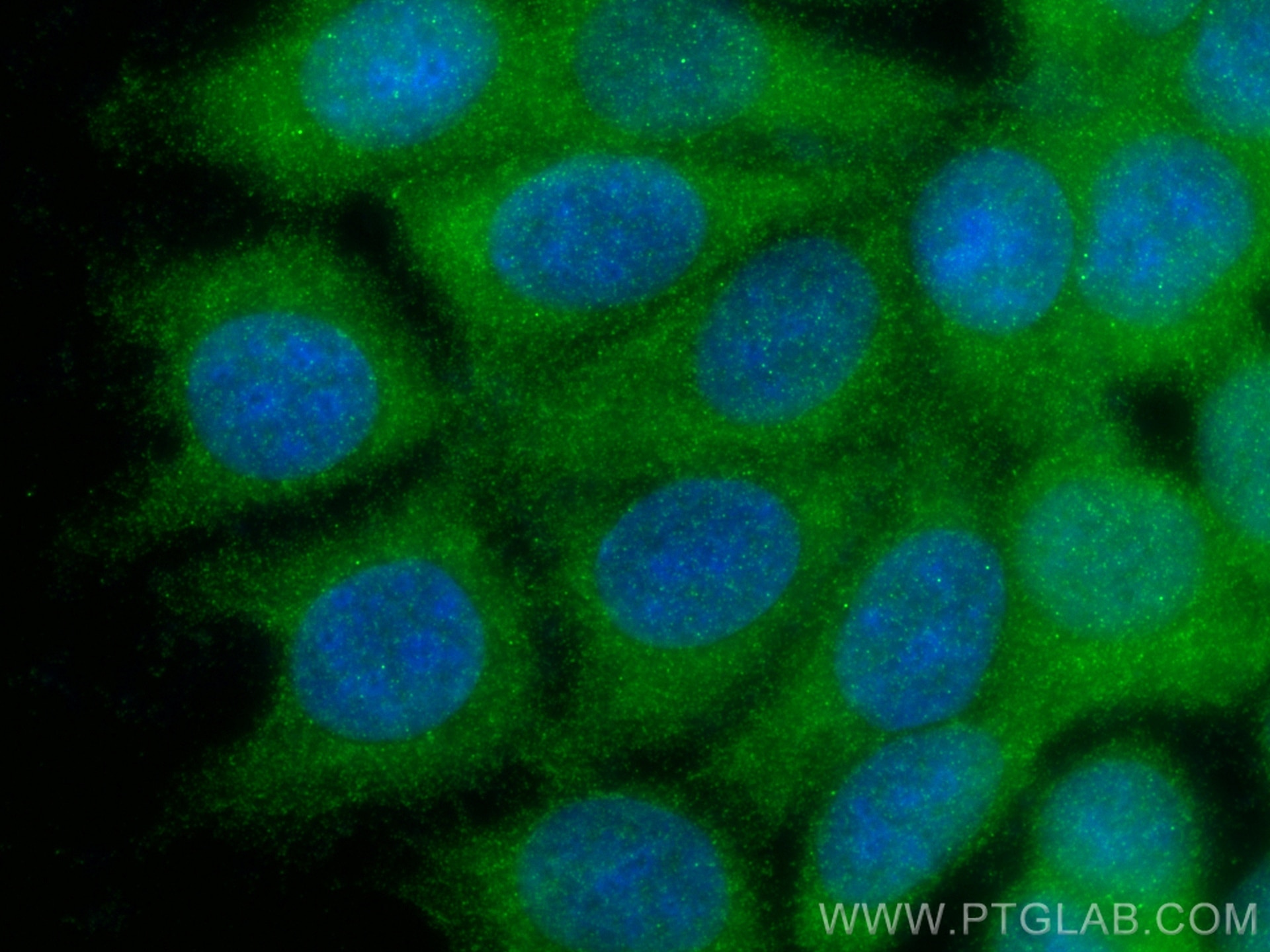 Immunofluorescence (IF) / fluorescent staining of MCF-7 cells using C11orf42 Polyclonal antibody (20919-1-AP)