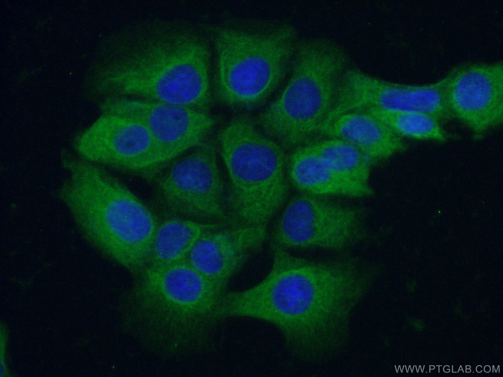 Immunofluorescence (IF) / fluorescent staining of MCF-7 cells using C11orf42 Polyclonal antibody (20919-1-AP)