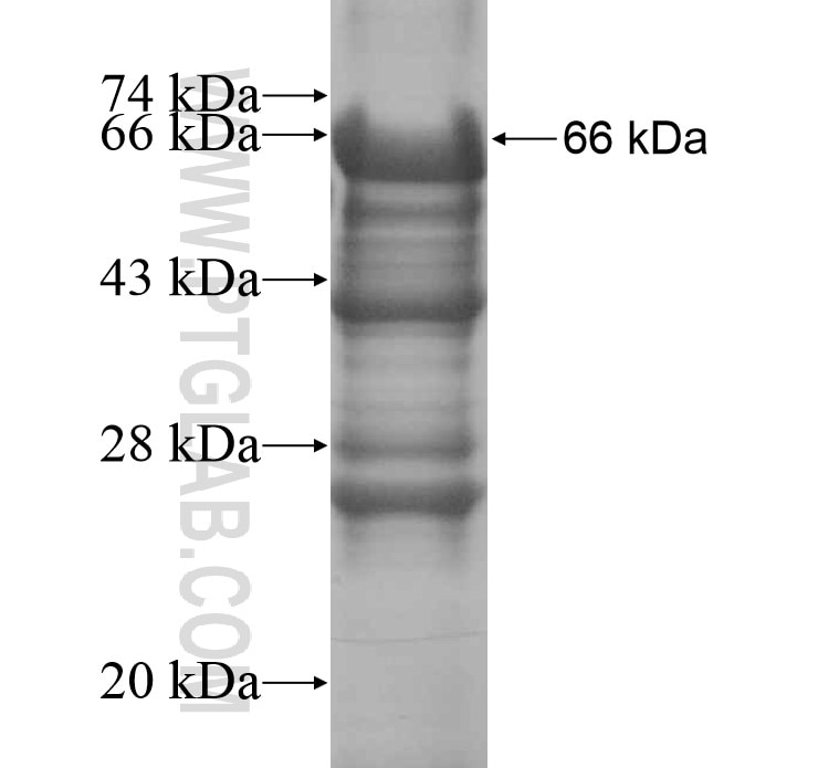 C11orf42 fusion protein Ag15118 SDS-PAGE