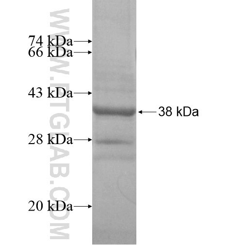 C11orf42 fusion protein Ag15326 SDS-PAGE