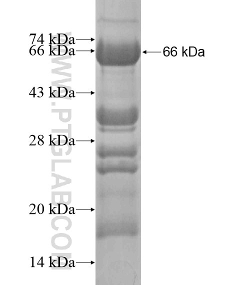 C11orf48 fusion protein Ag20027 SDS-PAGE