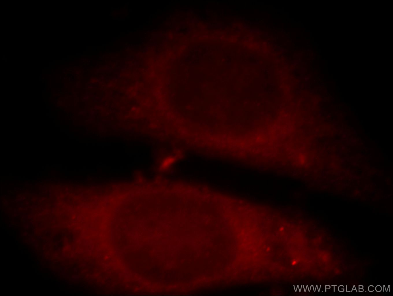 Immunofluorescence (IF) / fluorescent staining of HepG2 cells using C11orf49 Polyclonal antibody (20195-1-AP)