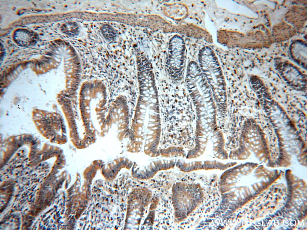 Immunohistochemistry (IHC) staining of human colon tissue using C11orf49 Polyclonal antibody (20195-1-AP)