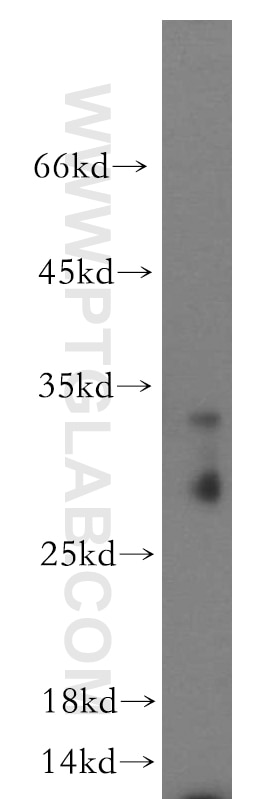 Western Blot (WB) analysis of human brain tissue using C11orf49 Polyclonal antibody (20195-1-AP)